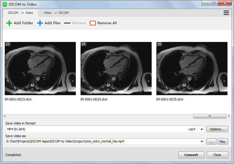 DICOM to Video 1.11.0