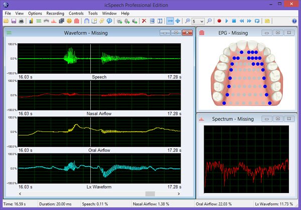 RoseMedical icSpeech Professional Edition 3.3.0