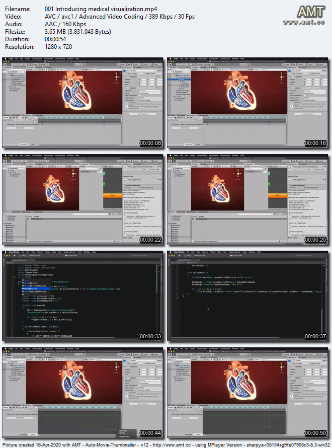 Unity Medical Visualization: 03 Deployment and Usability