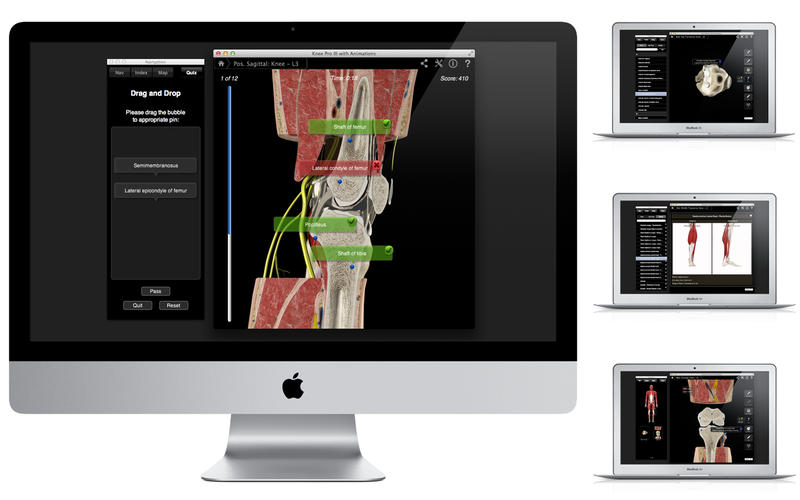 Knee Pro III with Animations v3.2.2 Mac OS X