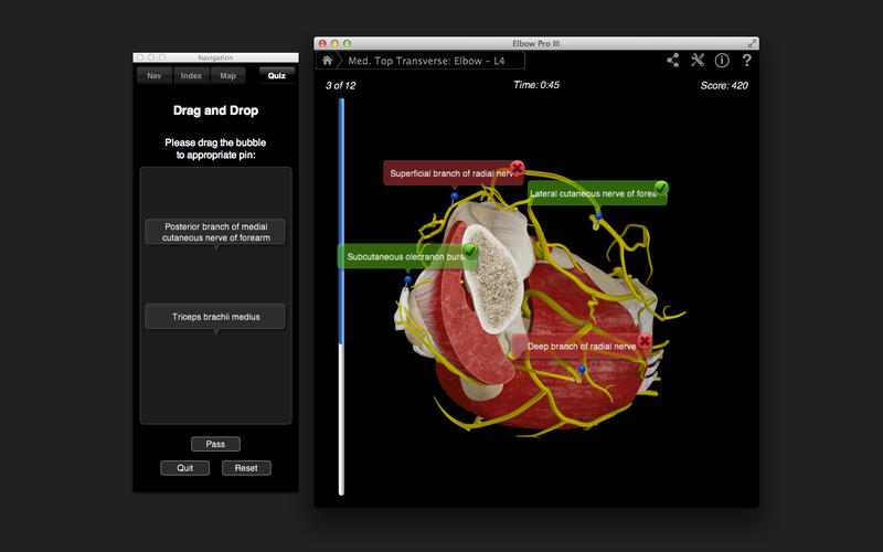 Elbow Pro III v3.0 Mac OS X