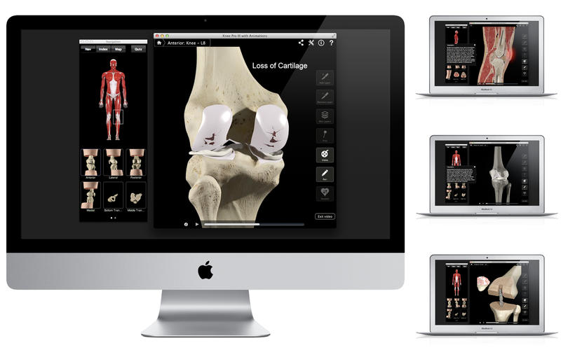 Knee Pro III with Animations v3.8 Mac OS X