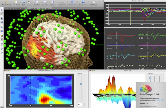 BrainVoyager QX 2.8.4