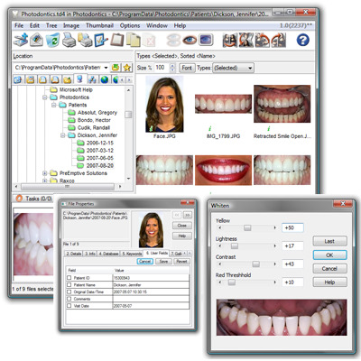 Photodontics Pro 1.0