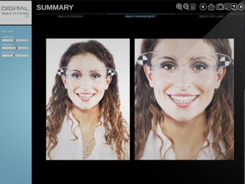 Digital Smile System 1.7.3