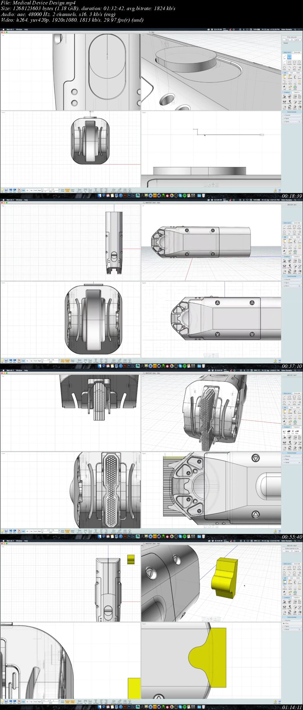 Medical Device Design with Edon Guraziu