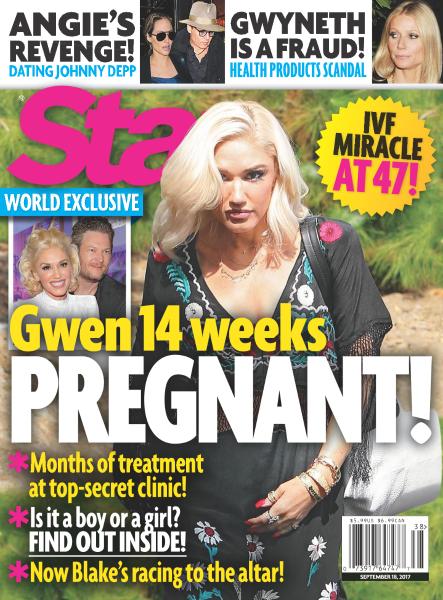 Star Magazine USA – September 18, 2017-P2P