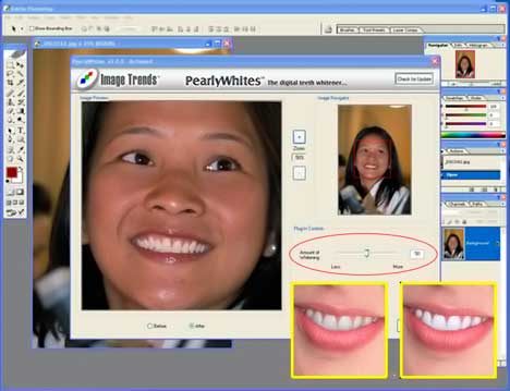 Image Trends PearlyWhites 2.2.1 for Adobe Photoshop