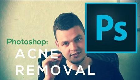 Photoshop: Easiest Way To Remove Acne