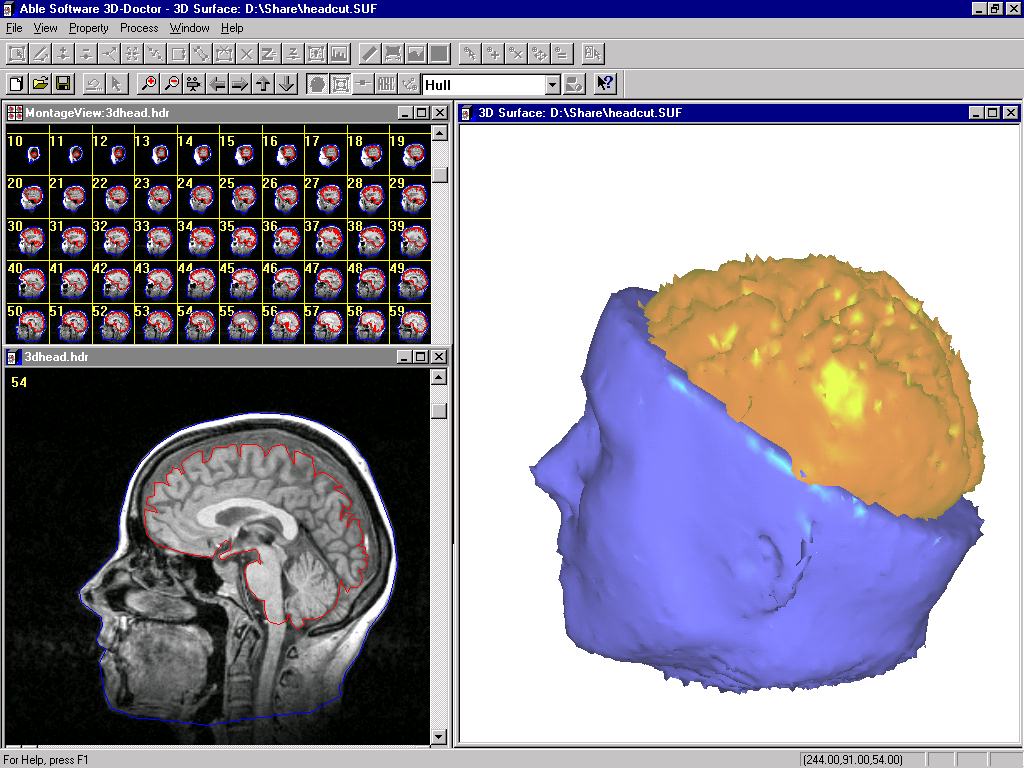 Able Software 3D-Doctor 4.0.20110710