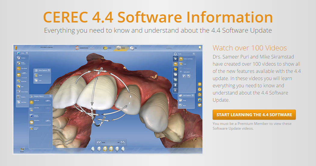 CEREC 4.4 Training Video (2015)